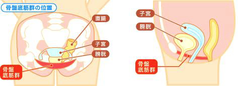 泌尿器科での尿漏れ治療について一部の泌尿器科でのEMSの使用例図説